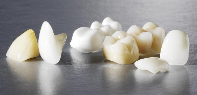 Dental Crowns, Caps or Artificial Teeth Dental Crowns, Caps or Artificial Teeth