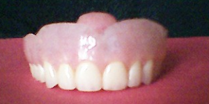 Complete Upper Dentures Raleigh NC dentures raleigh nc partials